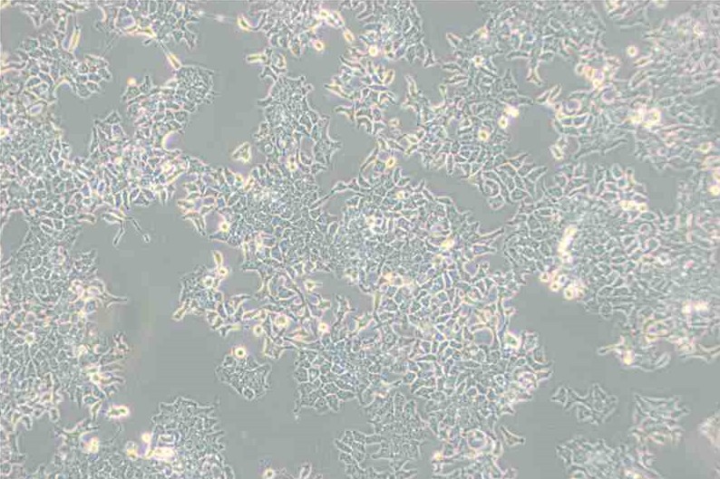 H-4-II-E 大鼠肝細(xì)胞瘤主圖