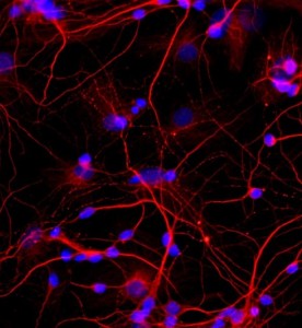 大鼠海馬神經(jīng)元細胞主圖