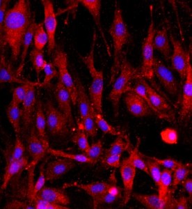 大鼠海綿體內皮細胞主圖