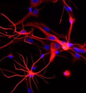 大鼠神經星形膠質細胞主圖