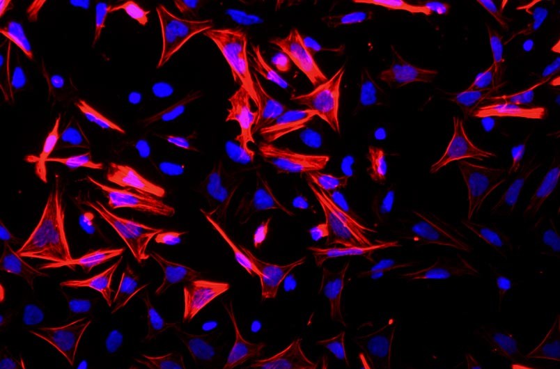 小鼠小腸平滑肌細胞主圖