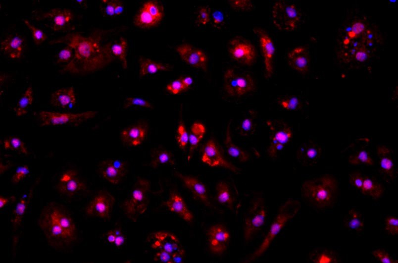 小鼠骨髓來源內皮祖細胞主圖