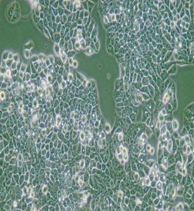 CX-1人結腸癌細胞主圖