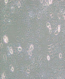 KYSE-30人食管鱗癌細胞主圖