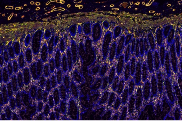 免疫熒光三標(biāo)四色染色主圖