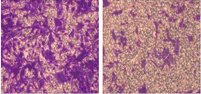 細胞侵襲結果示意圖